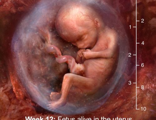 Gestational limits do not save lives